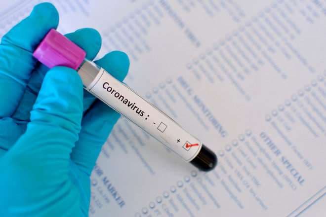 Estiman una vacuna para este 2020 contra el coronavirus